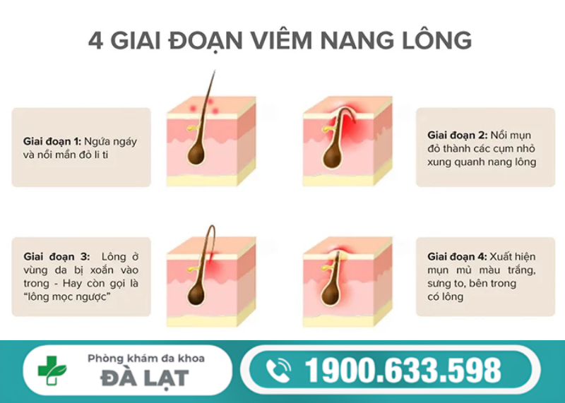 Hình ảnh minh họa